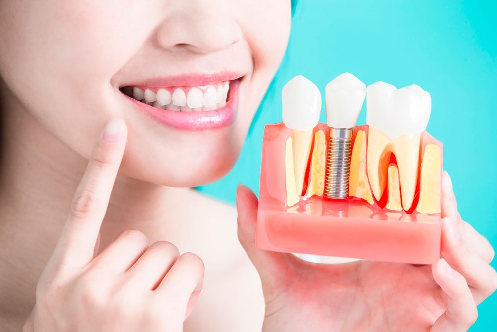 cropped-servicio-implantes-dentales-1.jpg