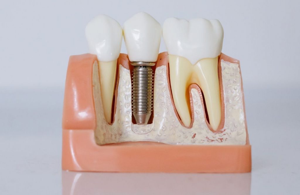 Clínica Dental Ananda